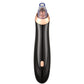 Electric Blackhead Vacuum